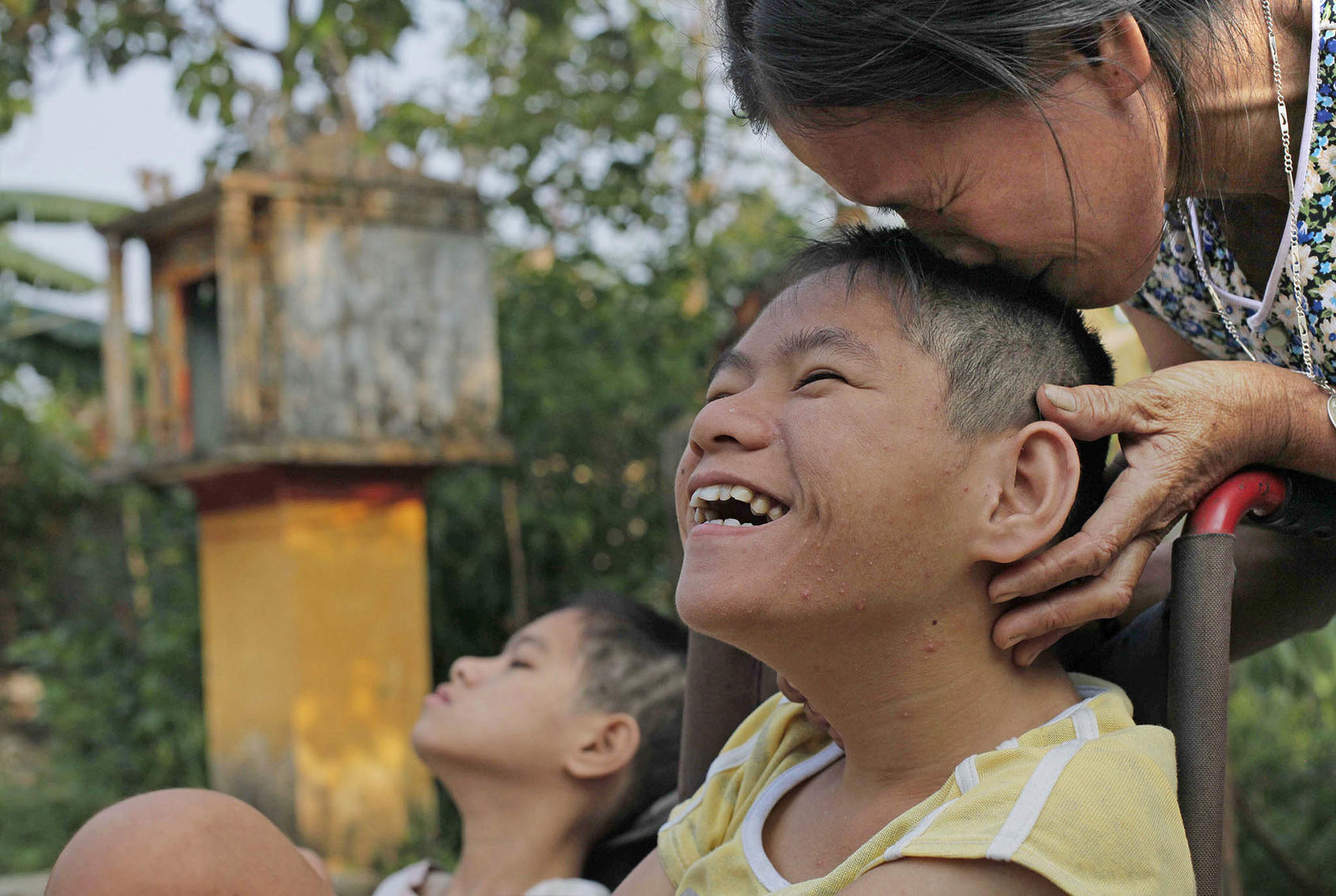 A woman with profound physical and mental disabilities attributed to Agent Orange is pictured on October 5, 2009, in Cam Tuyen, Vietnam. (Photo by David Guttenfelder/AP)